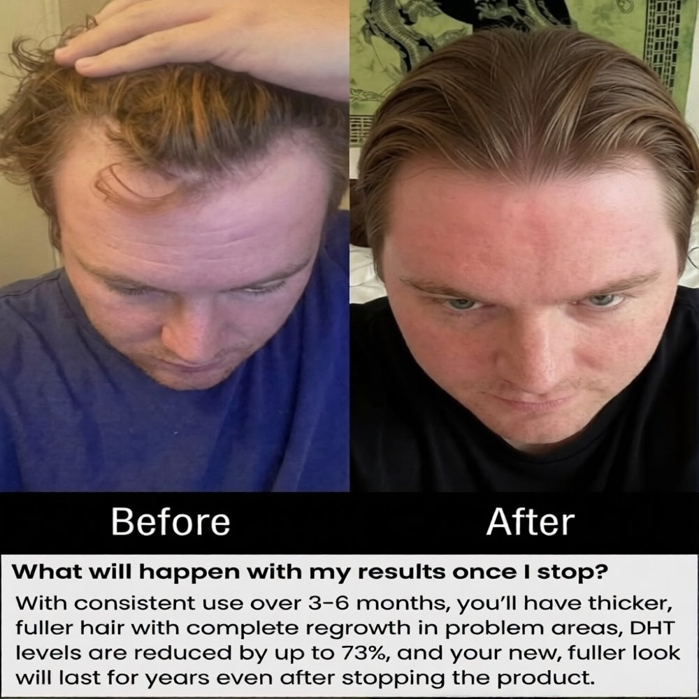 PrimalGrowth™ Hair Regrowth System
